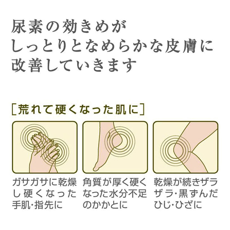 【第3類医薬品】ケラチナミン コーワ20%尿素配合クリーム 60g