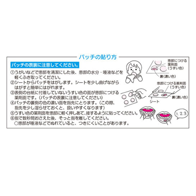 【指定第2類医薬品】口内炎パッチ 大正クイック 10枚